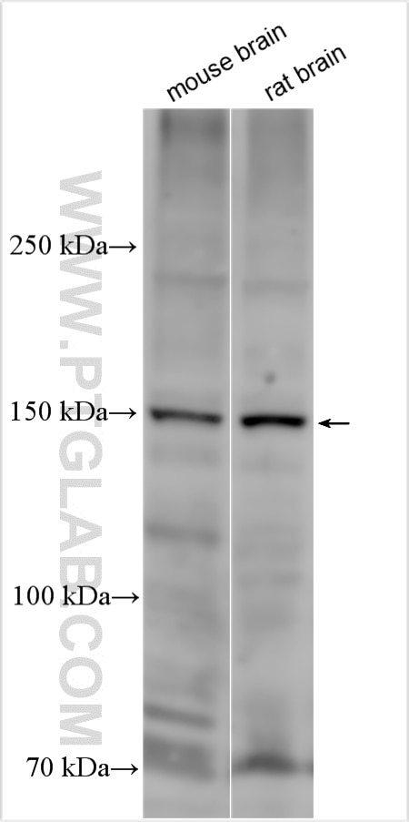 Western Blot (WB) analysis of various lysates using GRM5 Polyclonal antibody (28834-1-AP)