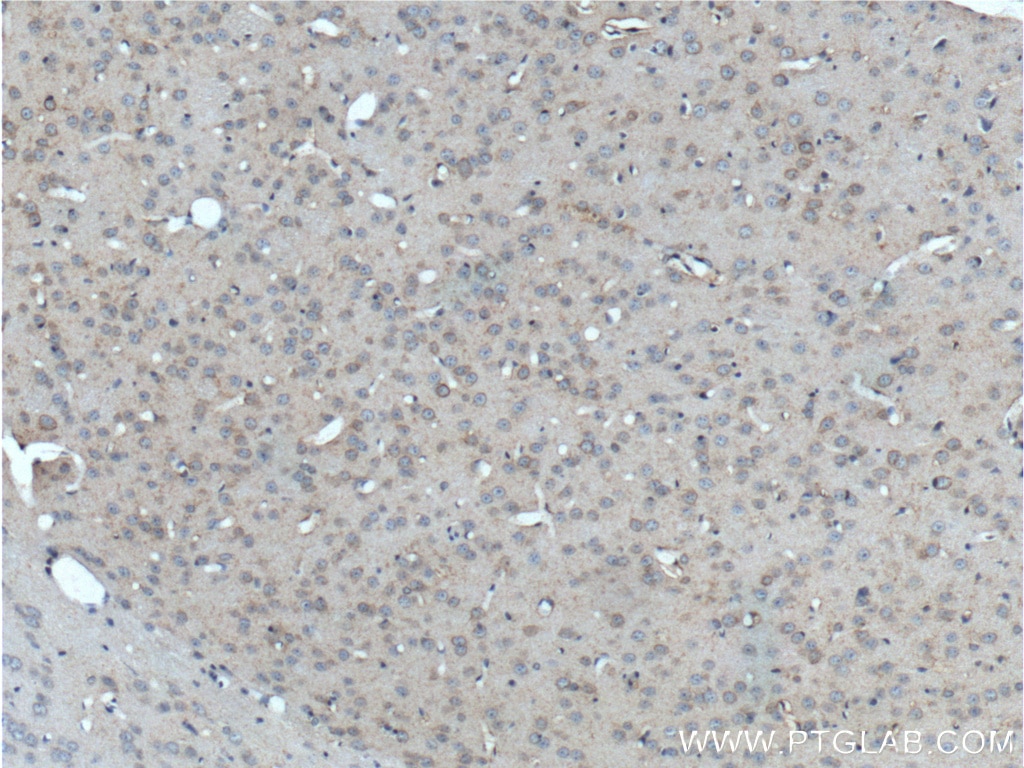 Immunohistochemistry (IHC) staining of mouse brain tissue using GRM8 Polyclonal antibody (18224-1-AP)