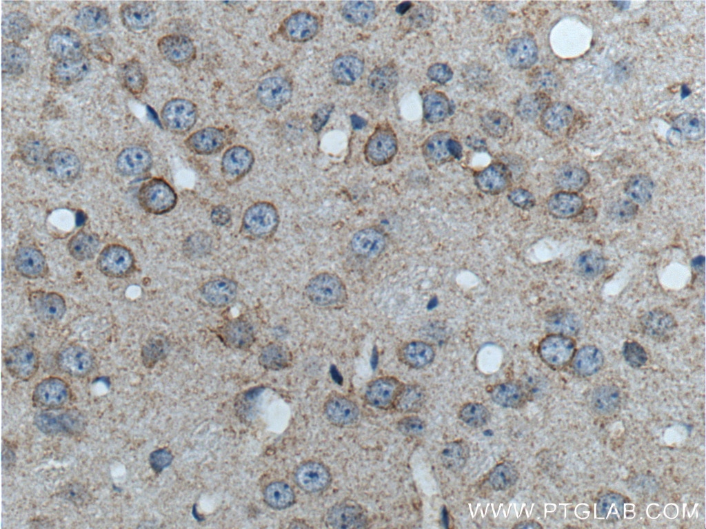 Immunohistochemistry (IHC) staining of mouse brain tissue using GRM8 Polyclonal antibody (18224-1-AP)