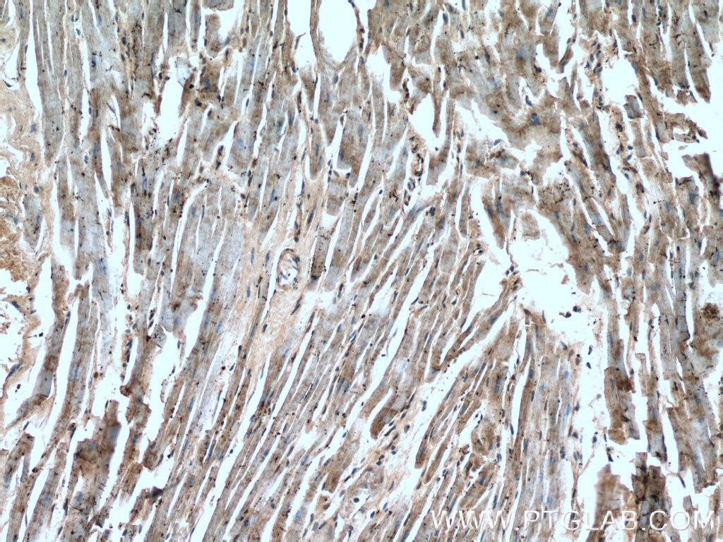 Immunohistochemistry (IHC) staining of human heart tissue using GRM8 Polyclonal antibody (18224-1-AP)