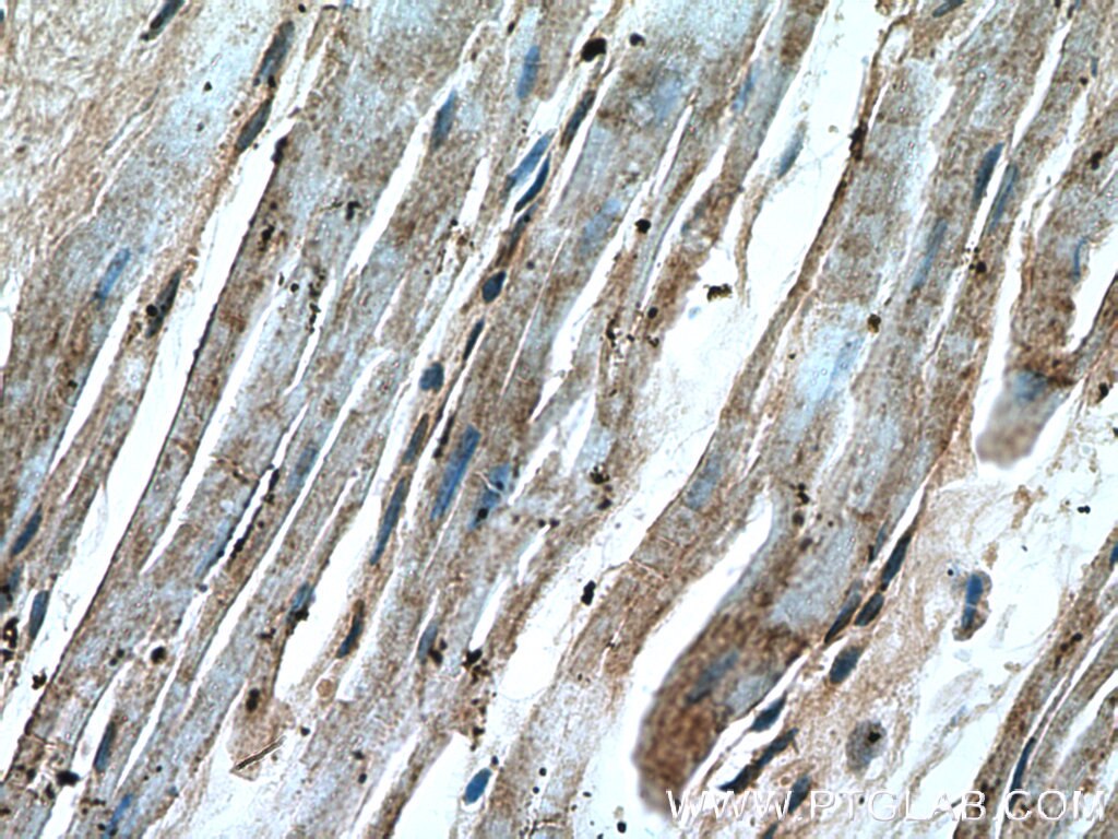 IHC staining of human heart using 18224-1-AP