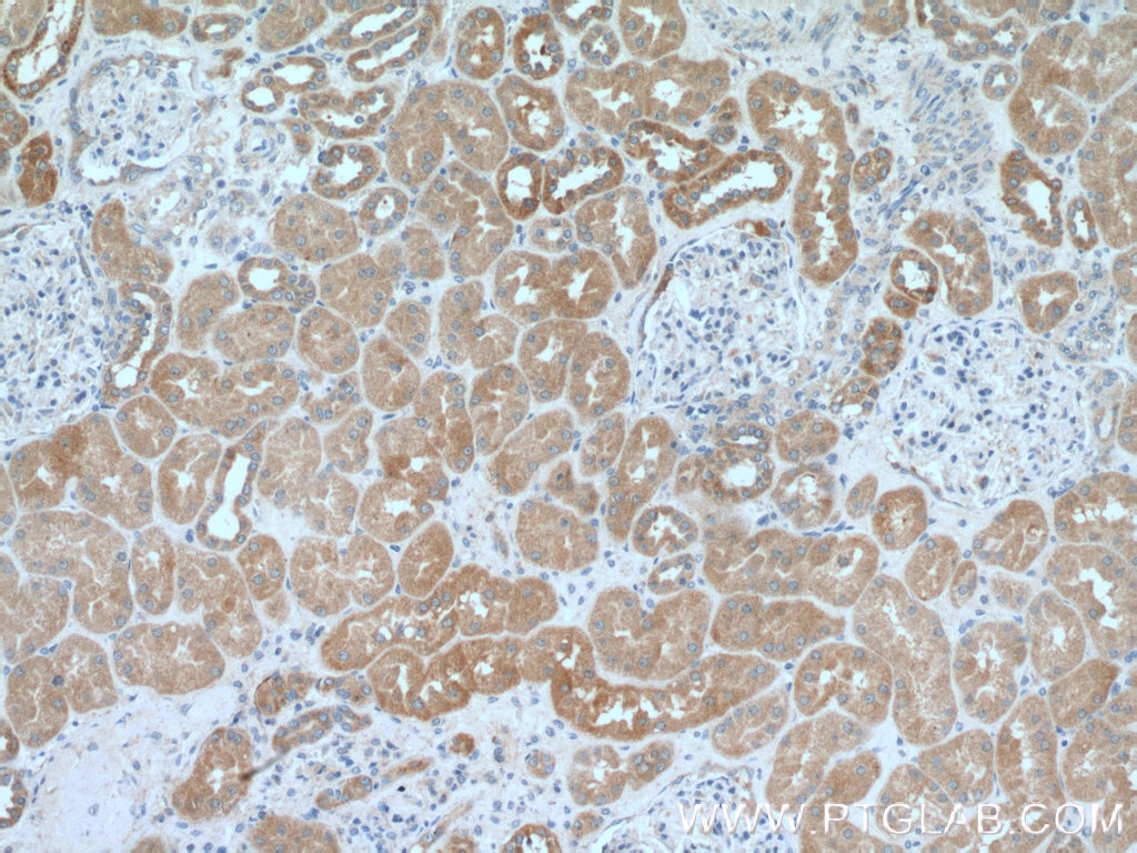 Immunohistochemistry (IHC) staining of human kidney tissue using GRN1/G Polyclonal antibody (25823-1-AP)