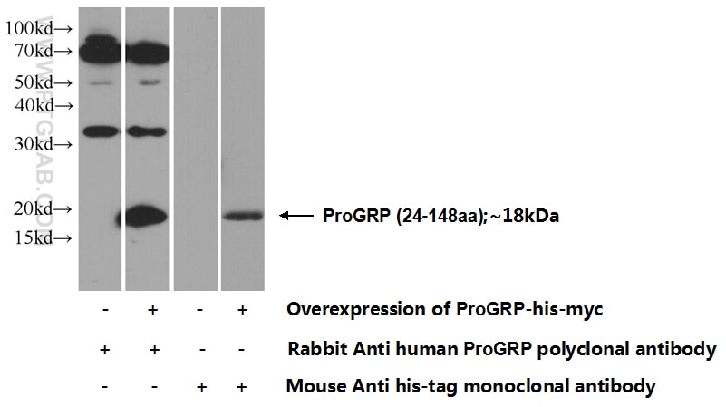 Western Blot (WB) analysis of Transfected HEK-293 cells using ProGRP Polyclonal antibody (14646-1-AP)