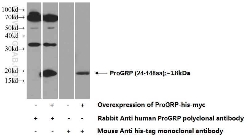 WB analysis of Transfected HEK-293 using 14646-1-AP