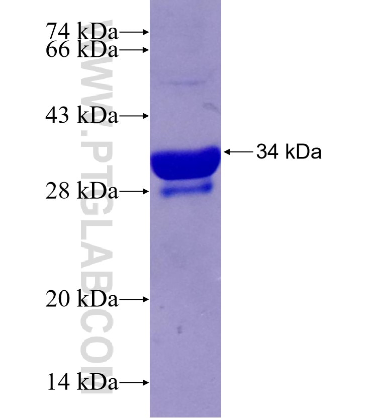 GRP fusion protein Ag29357 SDS-PAGE