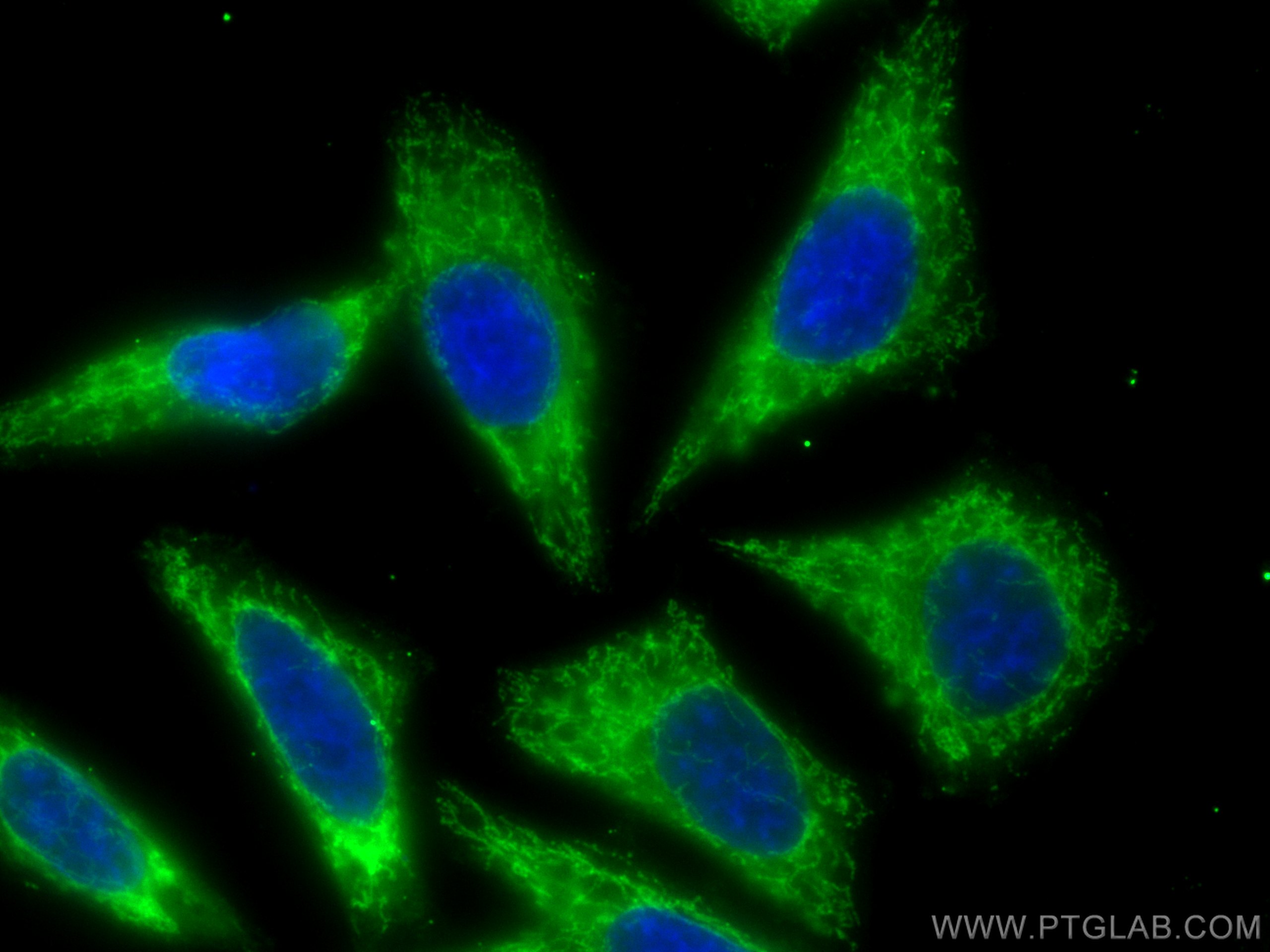 Immunofluorescence (IF) / fluorescent staining of HepG2 cells using CoraLite® Plus 488-conjugated GRP75 Polyclonal ant (CL488-14887)
