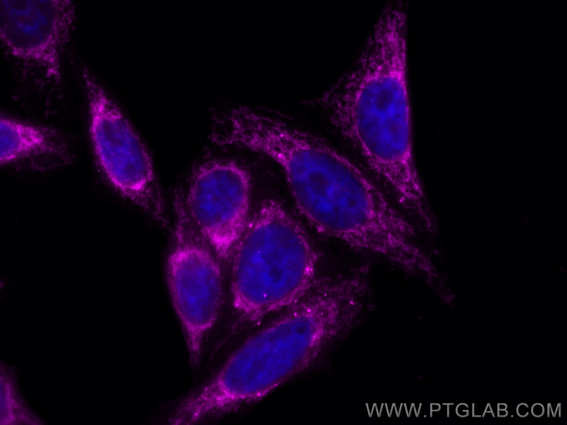 Immunofluorescence (IF) / fluorescent staining of HepG2 cells using CoraLite® Plus 647-conjugated GRP75 Polyclonal ant (CL647-14887)