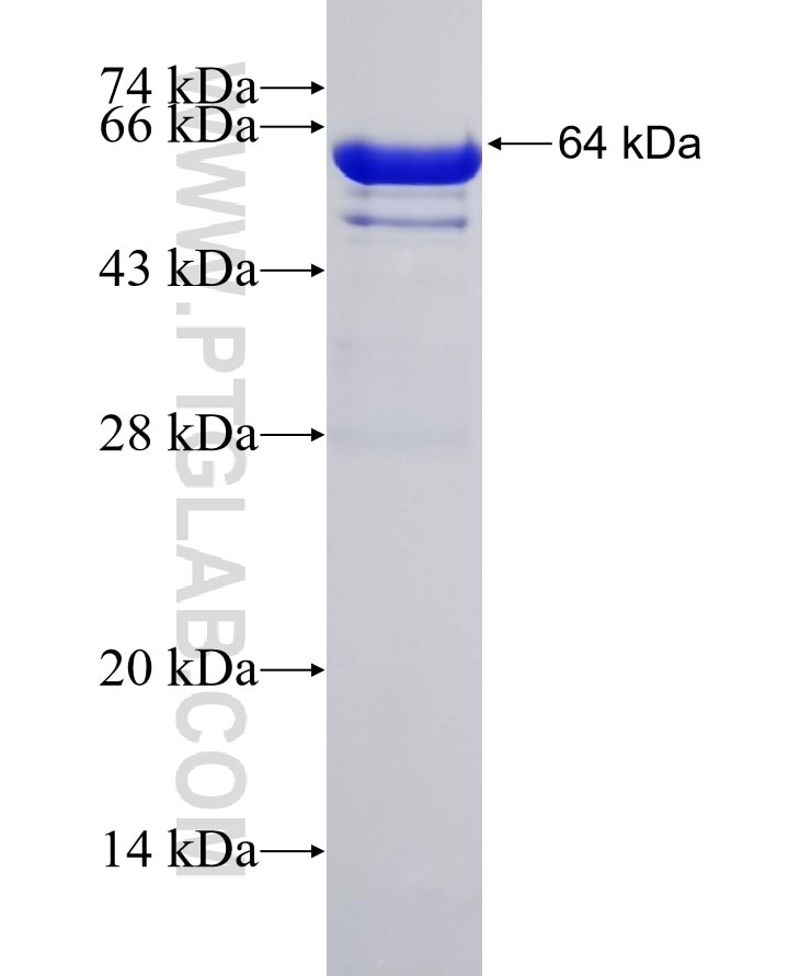 GRP75 fusion protein Ag6673 SDS-PAGE