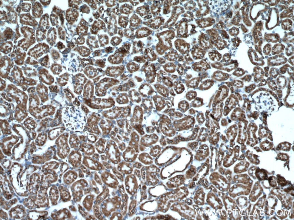 Immunohistochemistry (IHC) staining of mouse kidney tissue using GRP78/BIP Polyclonal antibody (11587-1-AP)