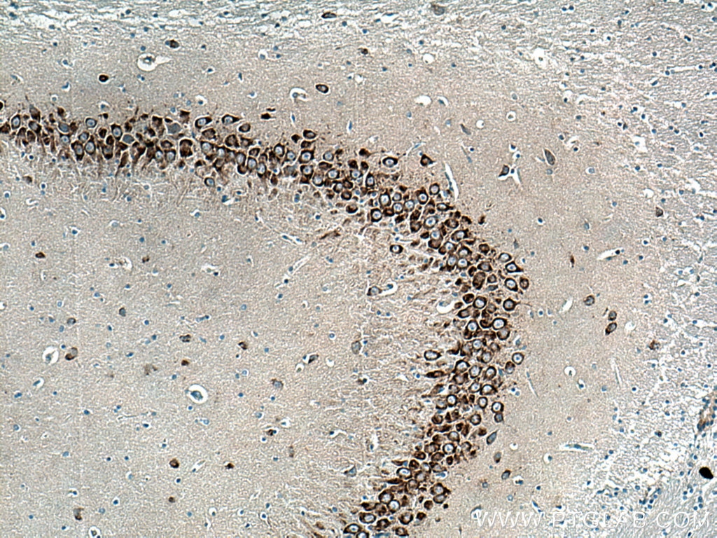 IHC staining of rat brain using 11587-1-AP