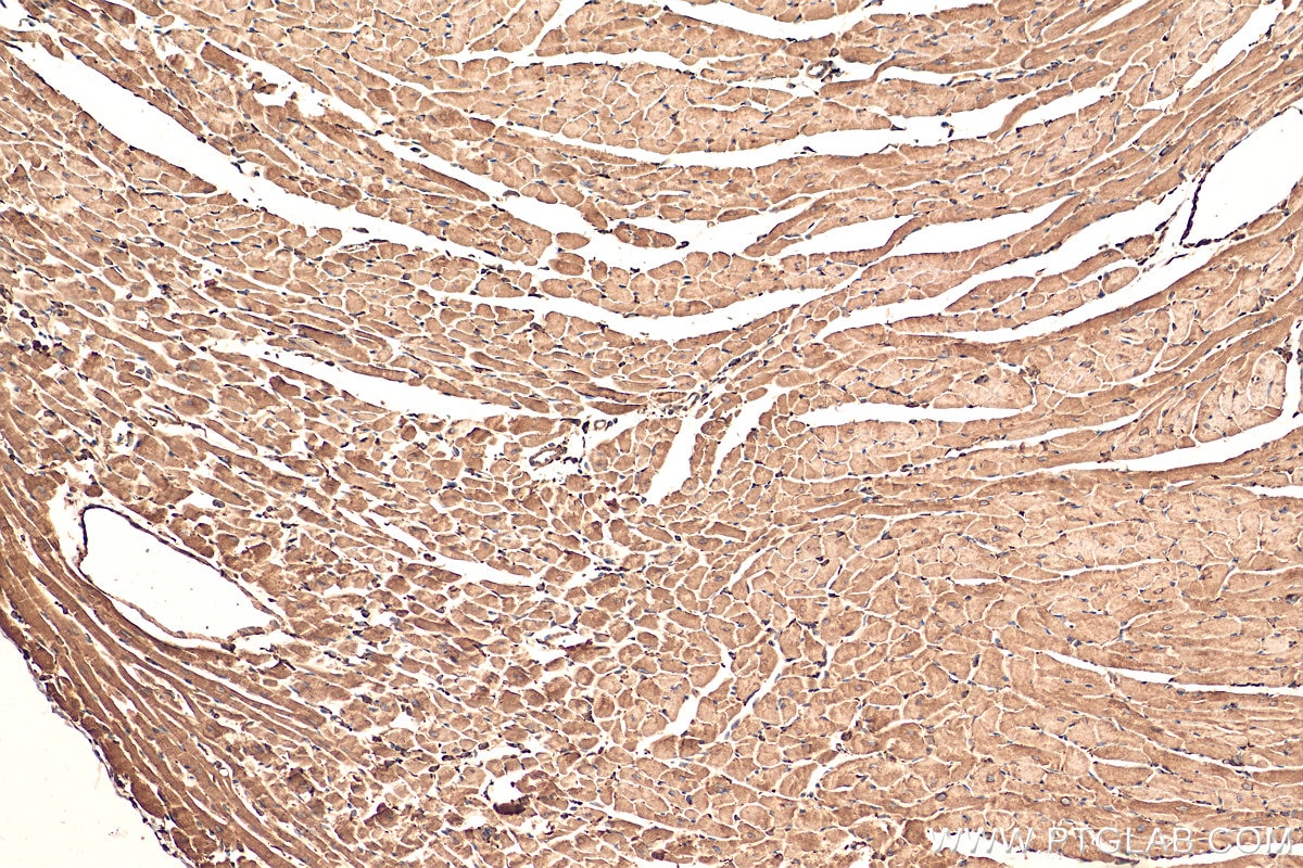 Immunohistochemistry (IHC) staining of mouse heart tissue using GRP78/BIP Polyclonal antibody (11587-1-AP)