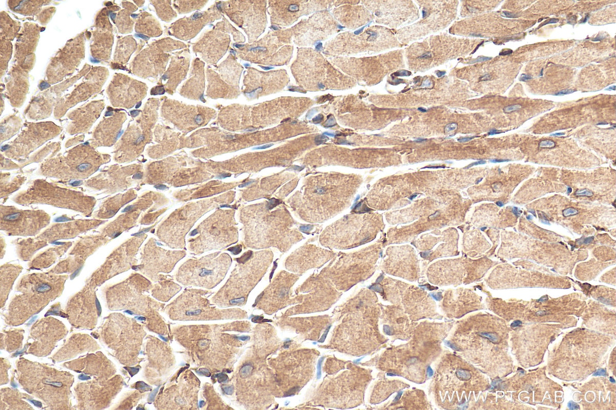 IHC staining of mouse heart using 11587-1-AP