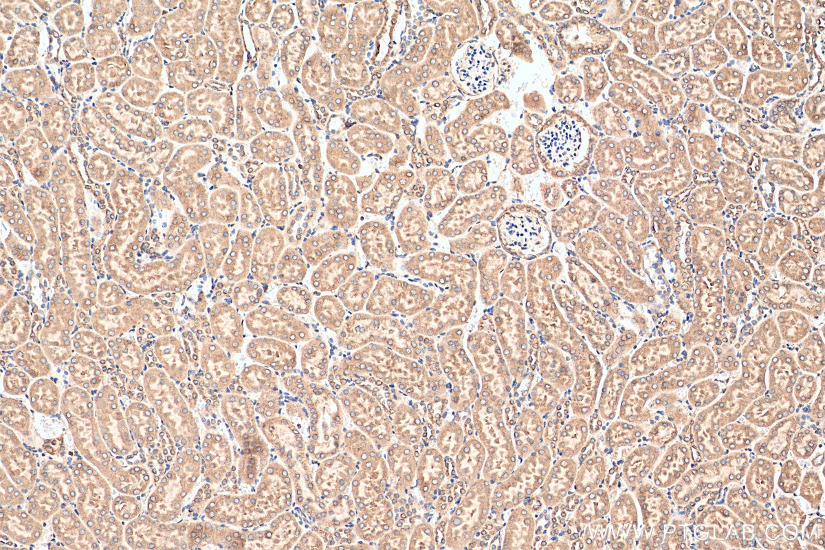 Immunohistochemistry (IHC) staining of mouse kidney tissue using GRP78/BIP Polyclonal antibody (11587-1-AP)