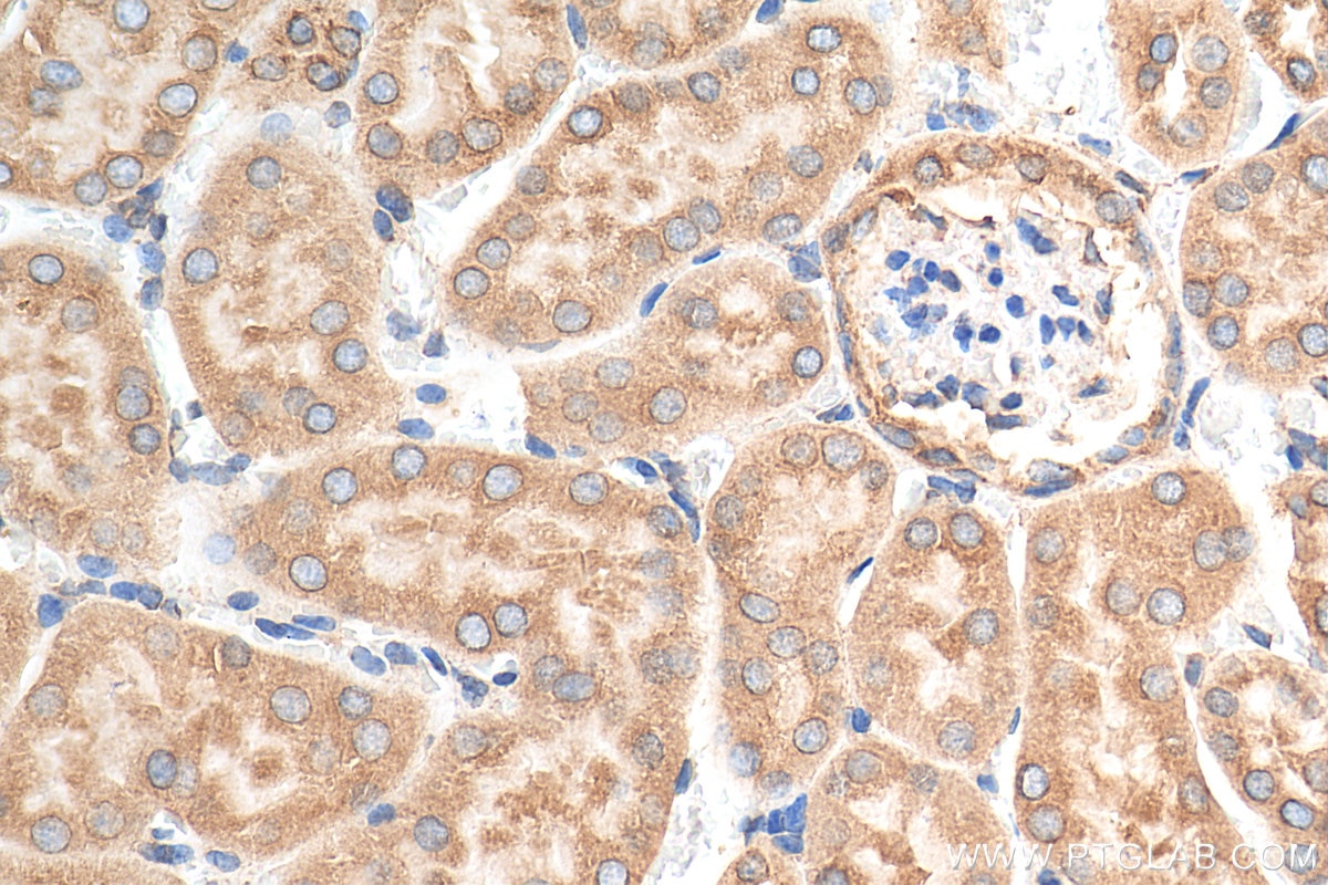 IHC staining of mouse kidney using 11587-1-AP