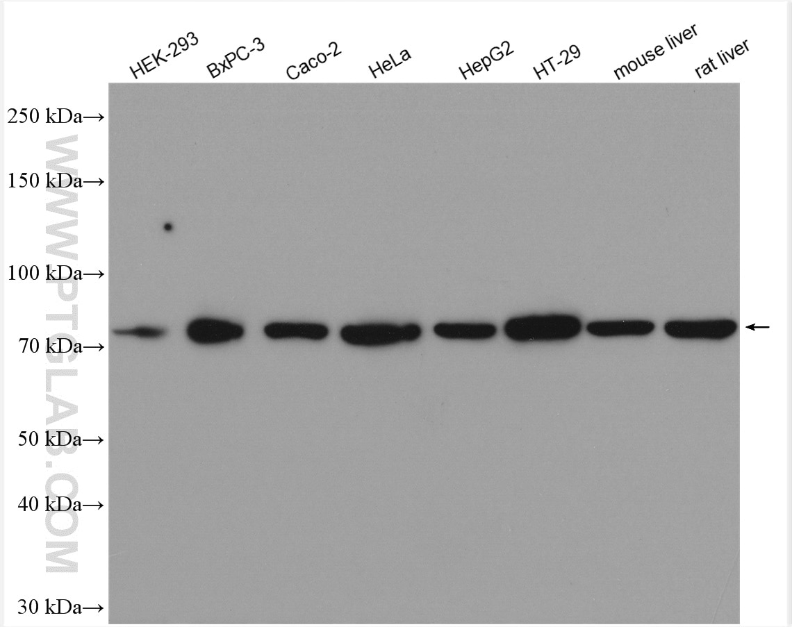 Western Blot (WB) analysis of various lysates using GRP78/BIP Polyclonal antibody (11587-1-AP)