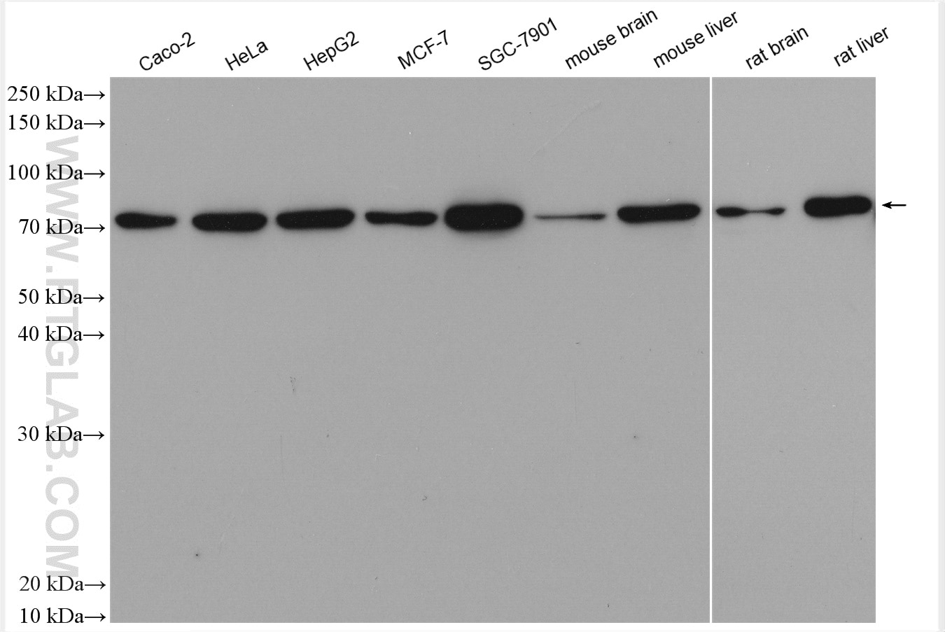 Western Blot (WB) analysis of various lysates using GRP78/BIP Polyclonal antibody (11587-1-AP)