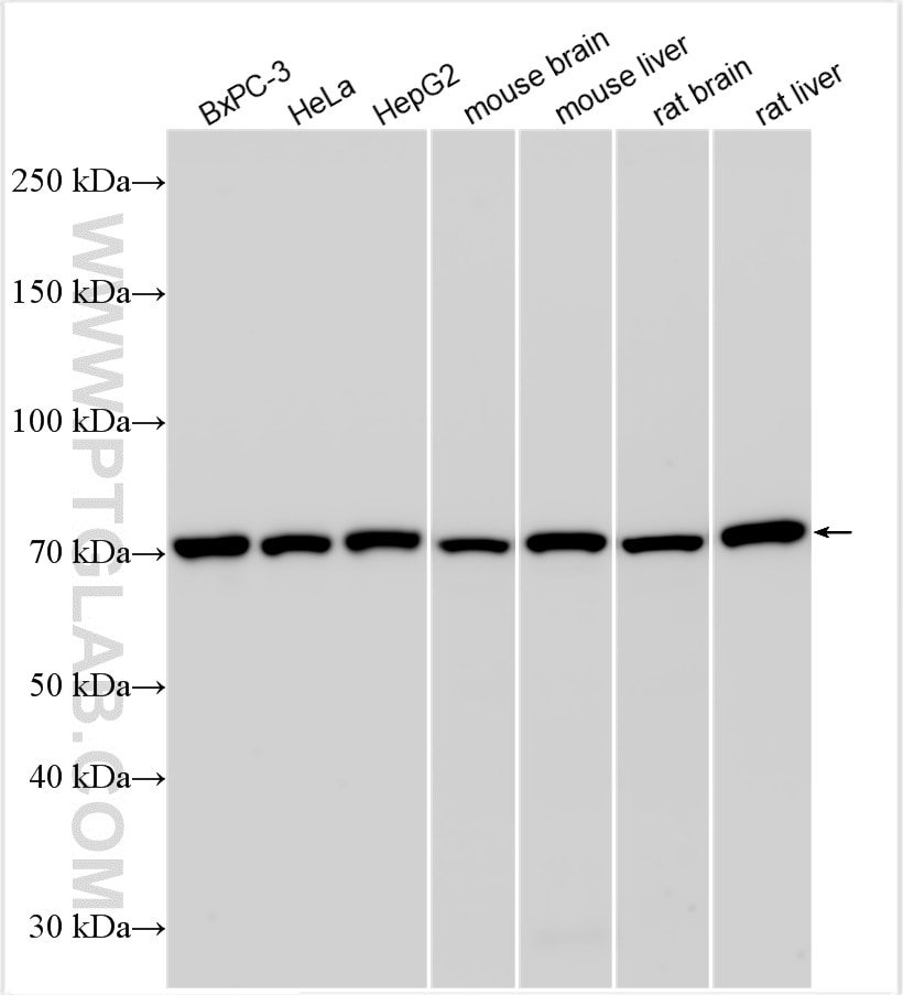 Western Blot (WB) analysis of various lysates using GRP78/BIP Polyclonal antibody (11587-1-AP)