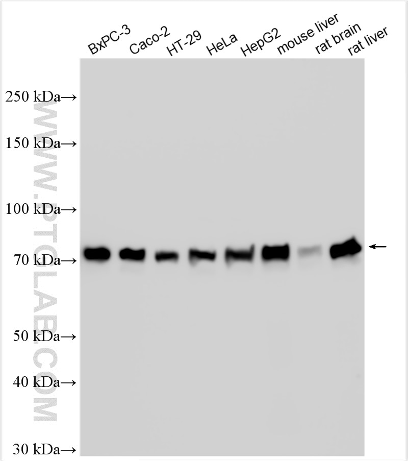 Western Blot (WB) analysis of various lysates using GRP78/BIP Polyclonal antibody (11587-1-AP)