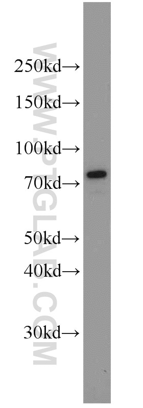 GRP78/BIP Polyclonal antibody