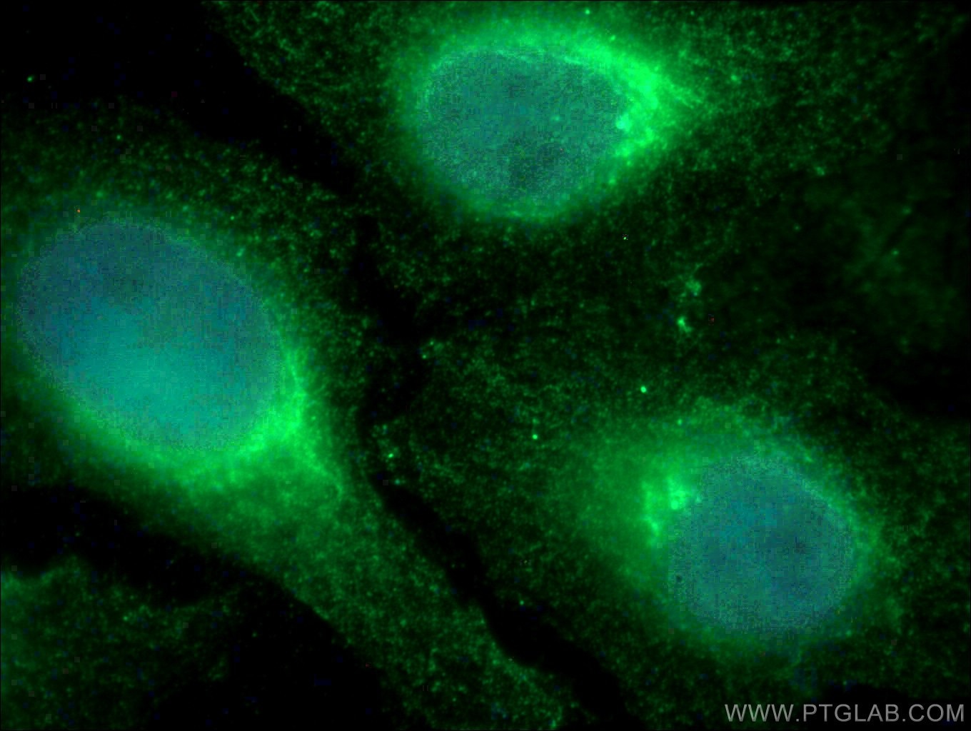 Immunofluorescence (IF) / fluorescent staining of HeLa cells using GRP78/BIP Monoclonal antibody (66574-1-Ig)