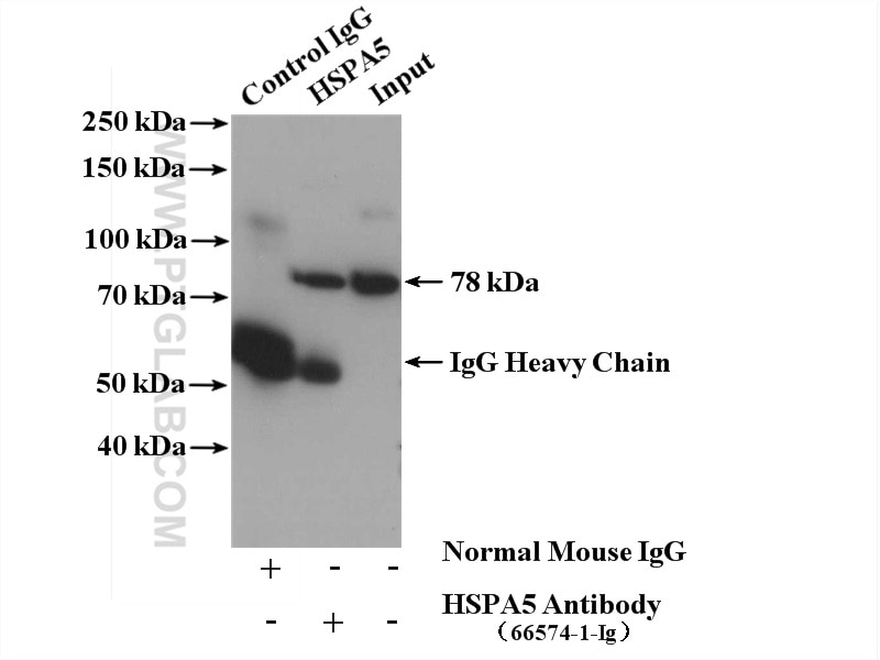 Immunoprecipitation (IP) experiment of SGC-7901 cells using GRP78/BIP Monoclonal antibody (66574-1-Ig)