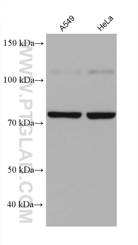 Western Blot (WB) analysis of various lysates using GRP78/BIP Monoclonal antibody (66574-1-Ig)