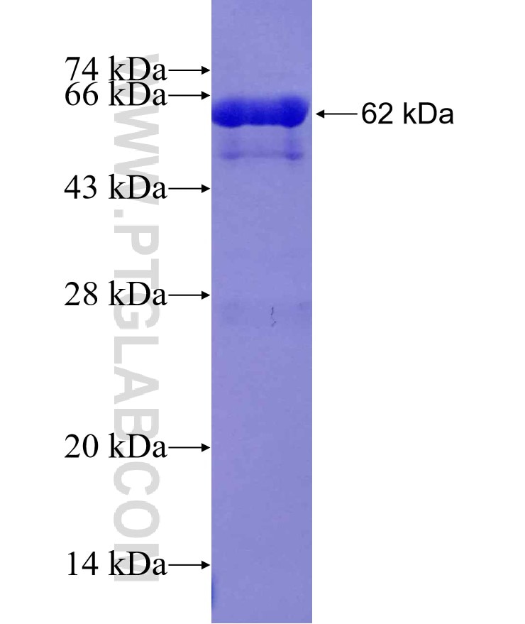 GRP78,BIP fusion protein Ag2188 SDS-PAGE