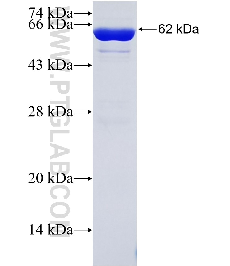 GRP78,BIP fusion protein Ag2188 SDS-PAGE