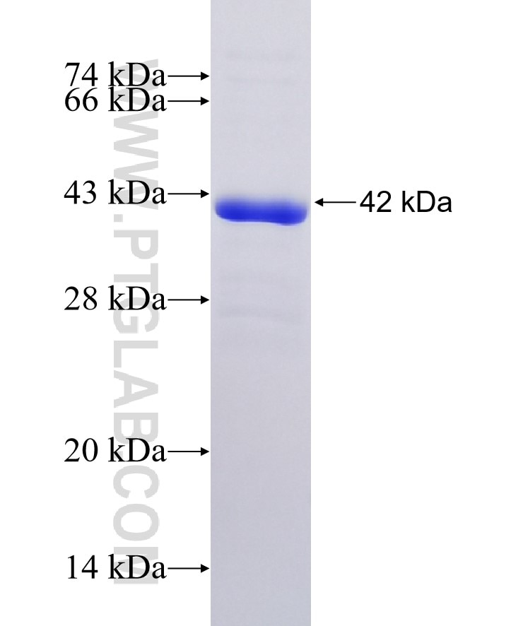 GRP78,BIP fusion protein Ag32370 SDS-PAGE
