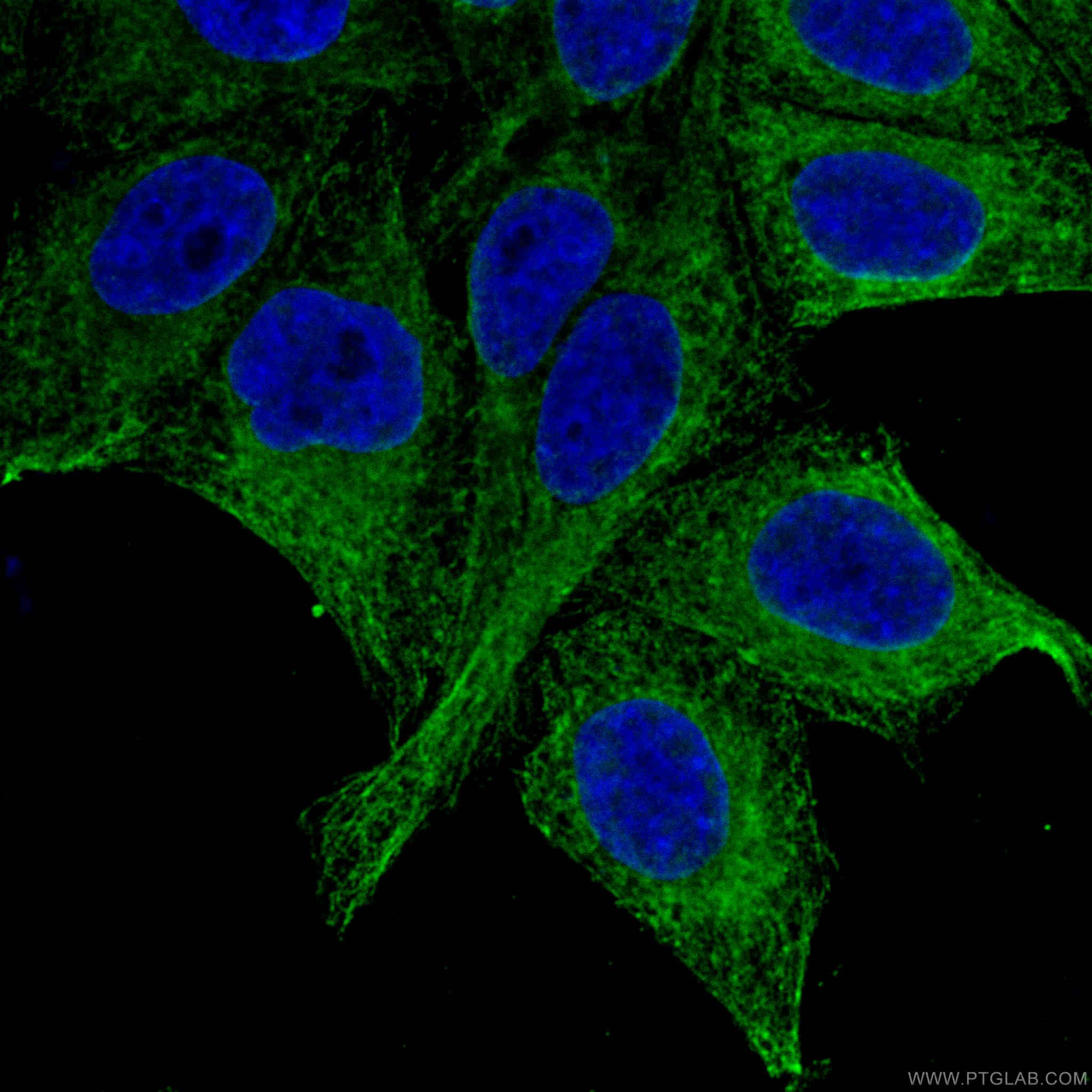 Immunofluorescence (IF) / fluorescent staining of HepG2 cells using GRP94 Monoclonal antibody (60012-2-Ig)