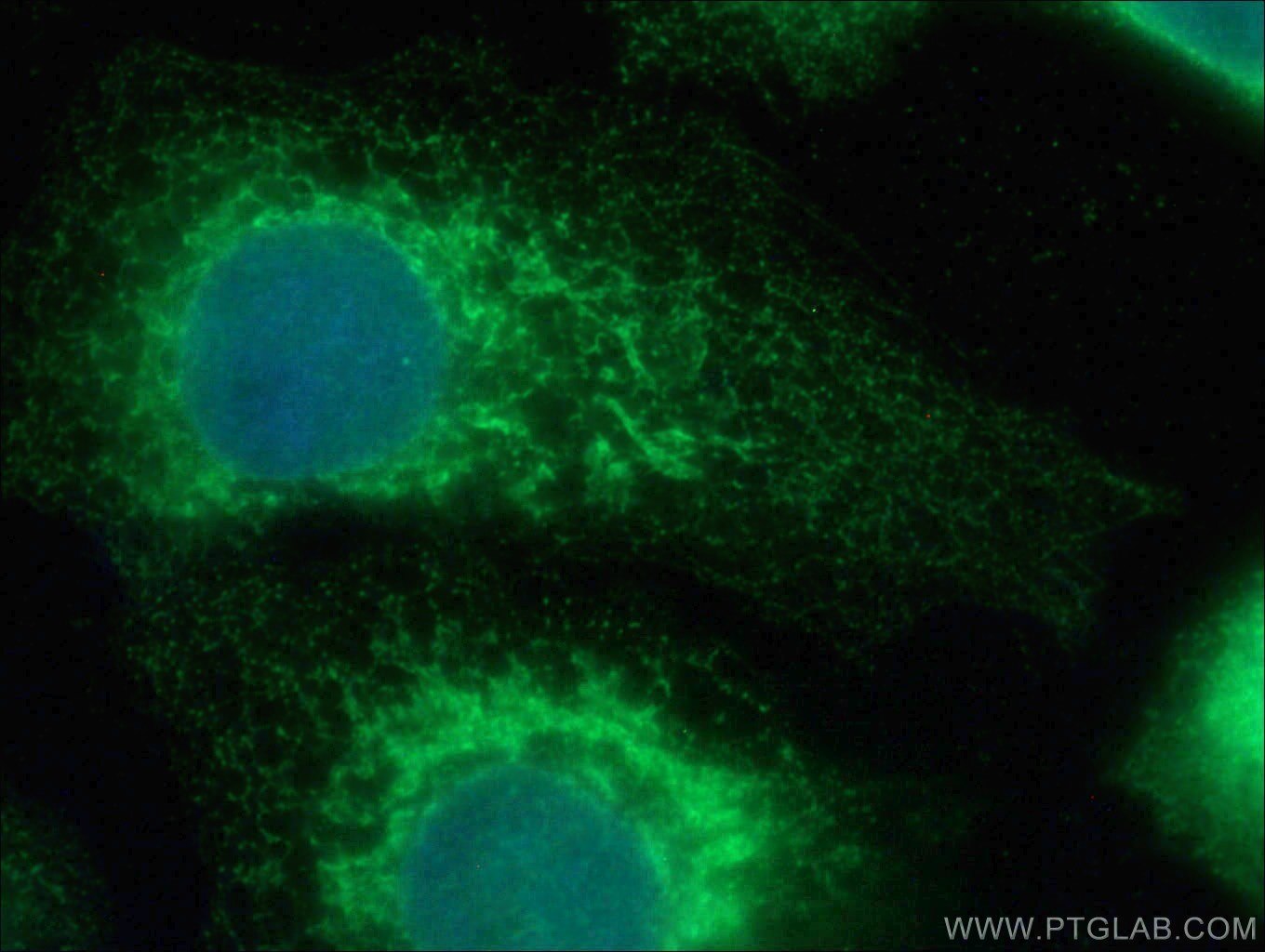 Immunofluorescence (IF) / fluorescent staining of A431 cells using GRP94 Monoclonal antibody (60012-2-Ig)