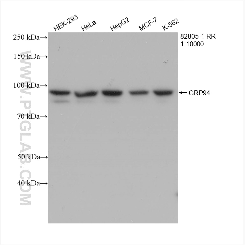 Western Blot (WB) analysis of various lysates using GRP94 Recombinant antibody (82805-1-RR)