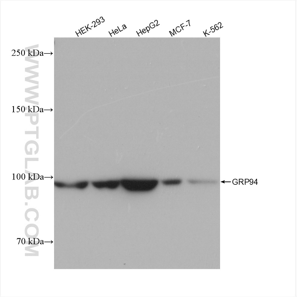Western Blot (WB) analysis of various lysates using GRP94 Recombinant antibody (82805-2-RR)