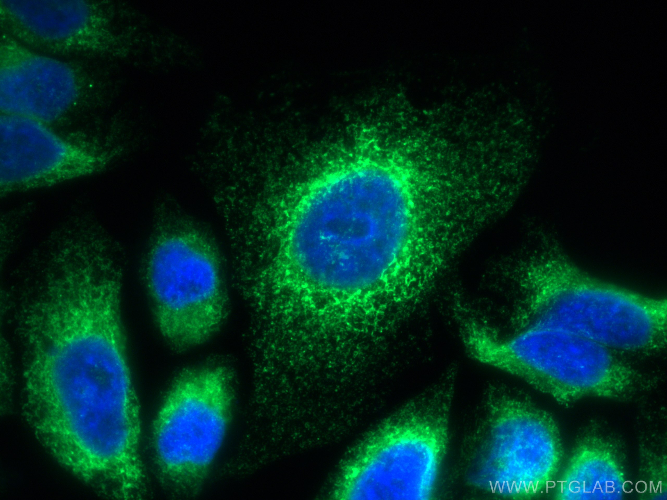 Immunofluorescence (IF) / fluorescent staining of HepG2 cells using CoraLite® Plus 488-conjugated GRP94 Polyclonal ant (CL488-14700)