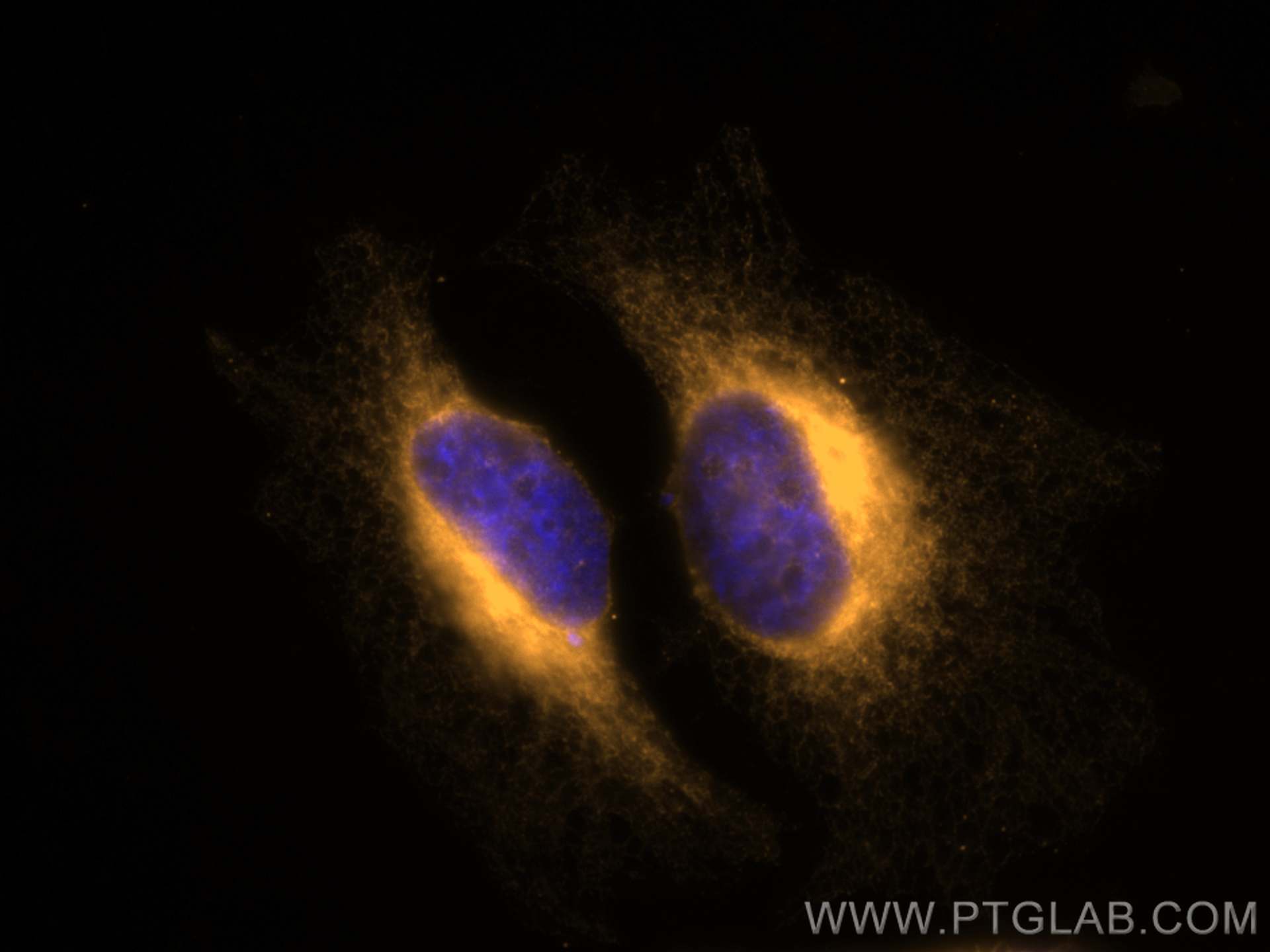 IF Staining of HeLa using CL555-14700