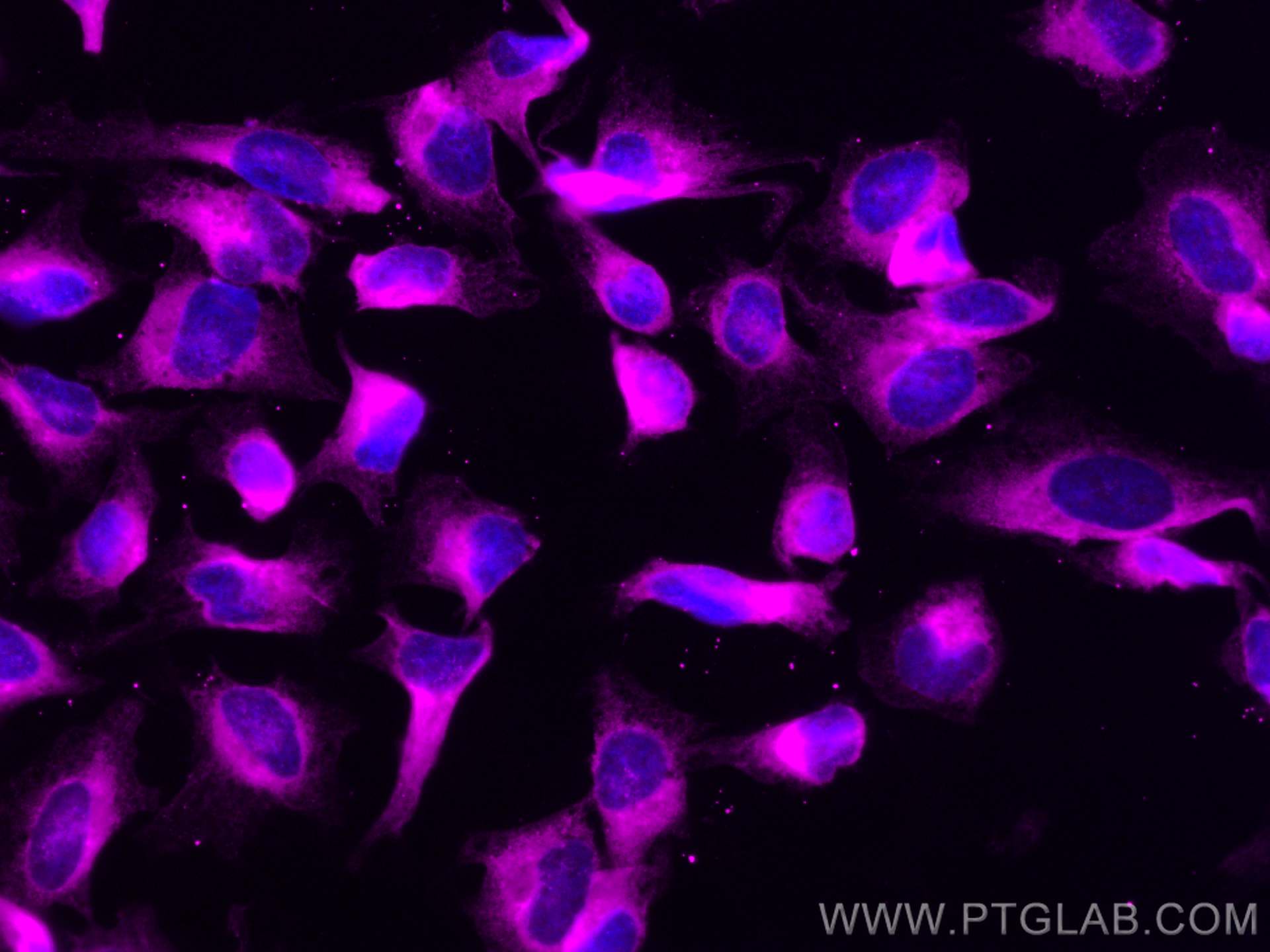 IF Staining of HeLa using CL647-14700