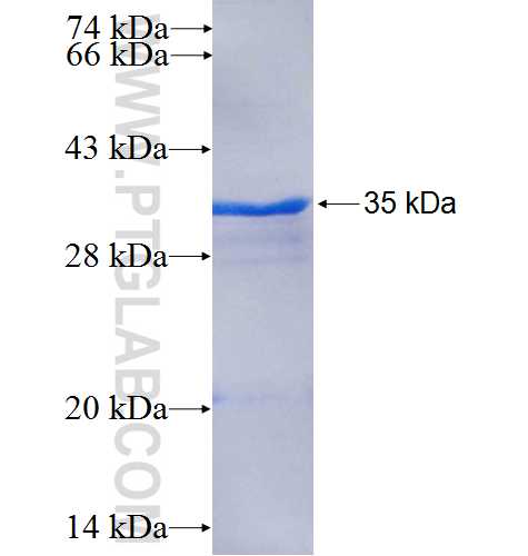 GRPR fusion protein Ag25450 SDS-PAGE