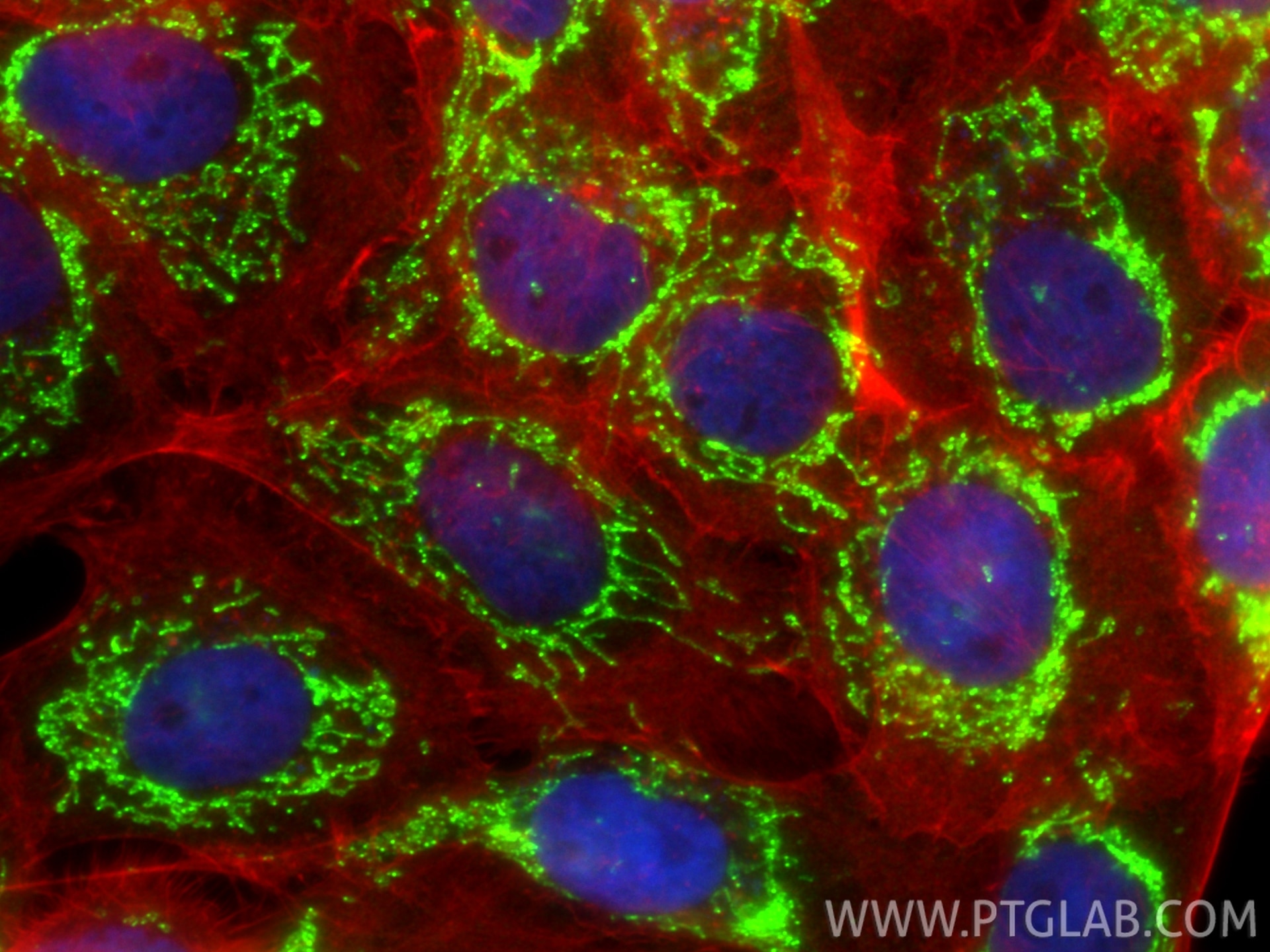 Immunofluorescence (IF) / fluorescent staining of A431 cells using GRSF1 Polyclonal antibody (30992-1-AP)