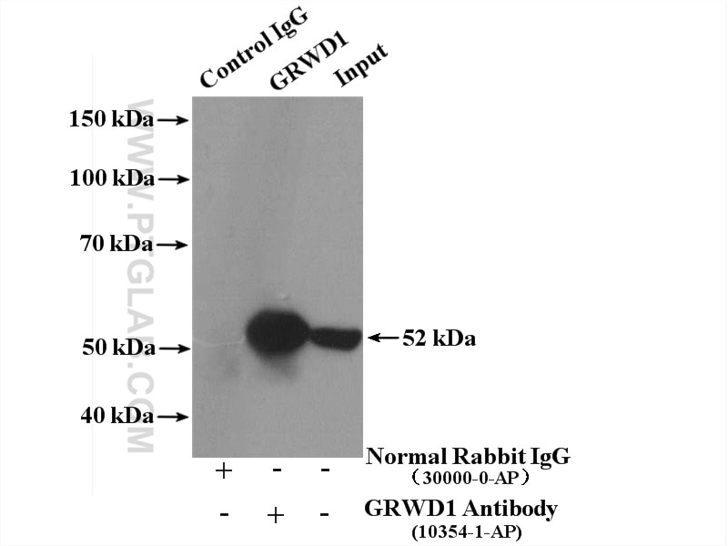 Immunoprecipitation (IP) experiment of PC-3 cells using GRWD1 Polyclonal antibody (10354-1-AP)