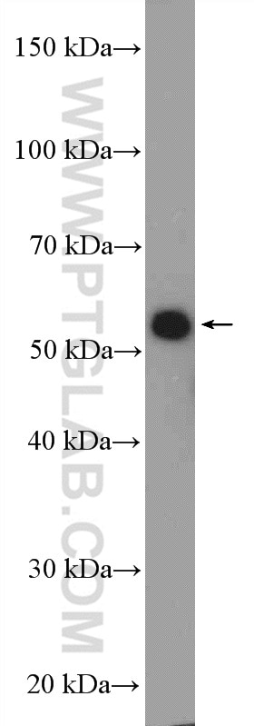 Western Blot (WB) analysis of HEK-293 cells using GRWD1 Polyclonal antibody (10354-1-AP)