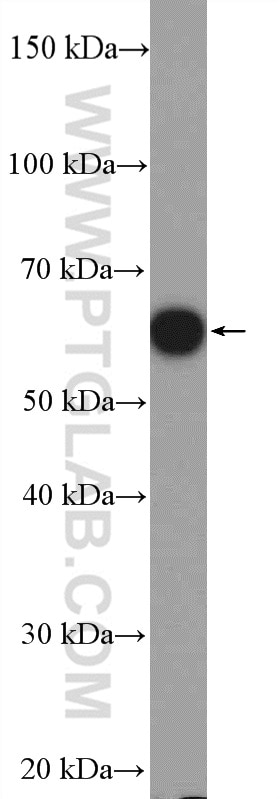 Western Blot (WB) analysis of PC-3 cells using GRWD1 Polyclonal antibody (10354-1-AP)