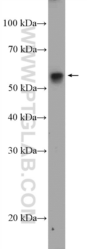 Western Blot (WB) analysis of SKOV-3 cells using GRWD1 Polyclonal antibody (10354-1-AP)