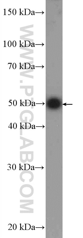 Western Blot (WB) analysis of HEK-293 cells using GRWD1 Polyclonal antibody (10354-1-AP)