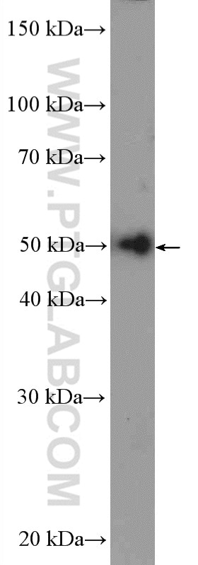 Western Blot (WB) analysis of HEK-293 cells using GRWD1 Polyclonal antibody (10354-1-AP)