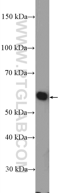 Western Blot (WB) analysis of PC-3 cells using GRWD1 Polyclonal antibody (10354-1-AP)