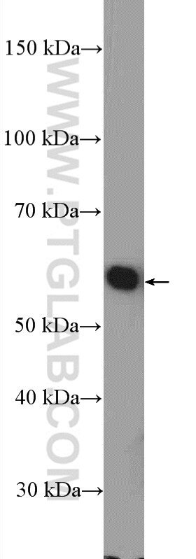 Western Blot (WB) analysis of PC-3 cells using GRWD1 Polyclonal antibody (10354-1-AP)