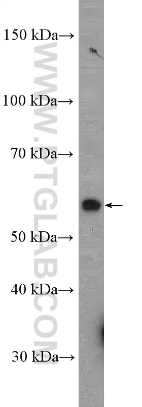 Western Blot (WB) analysis of PC-3 cells using GRWD1 Polyclonal antibody (10354-1-AP)