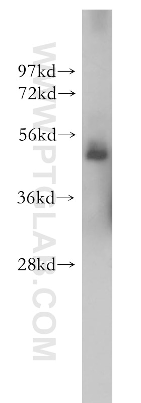 Western Blot (WB) analysis of HEK-293 cells using GRWD1 Polyclonal antibody (10354-1-AP)