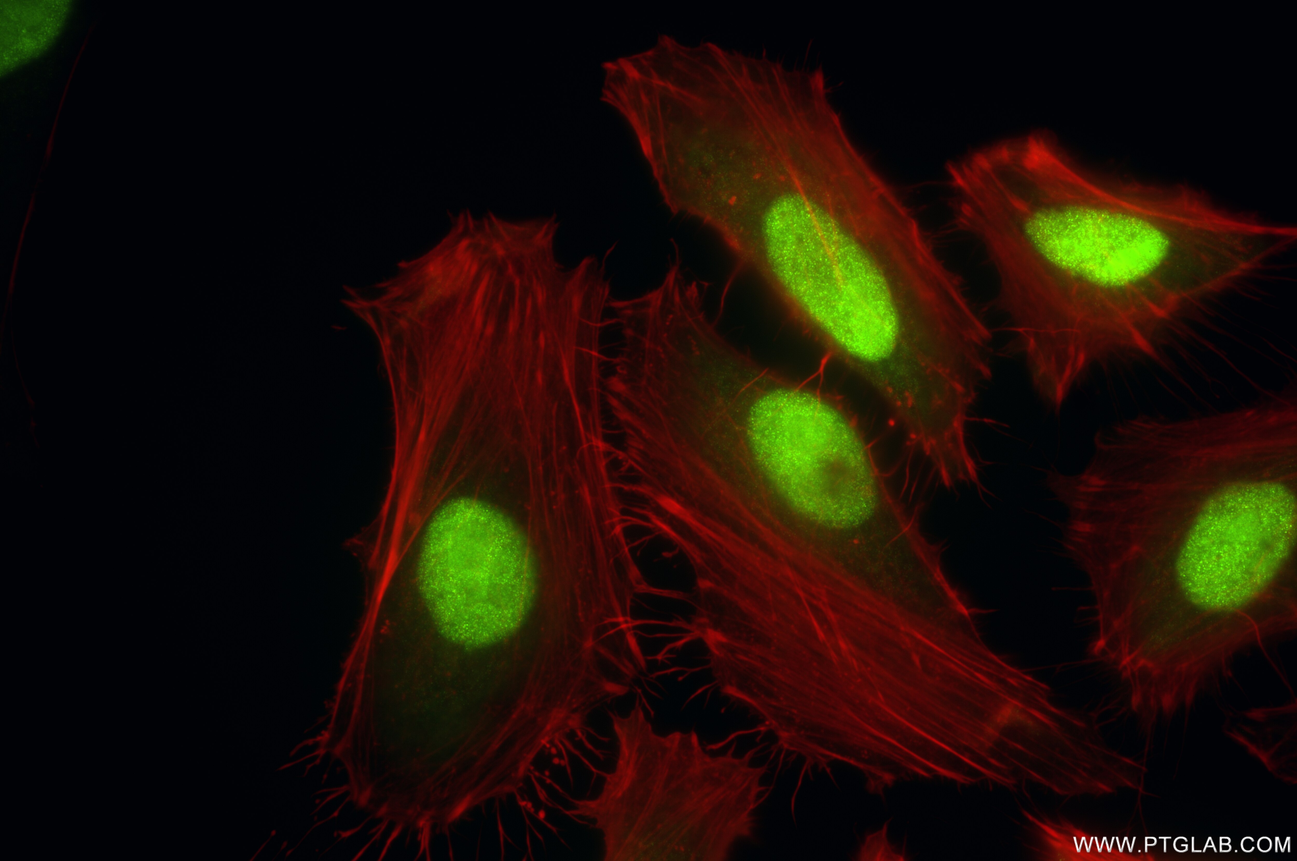 Immunofluorescence (IF) / fluorescent staining of HeLa cells using GRWD1 Recombinant antibody (86451-3-RR)
