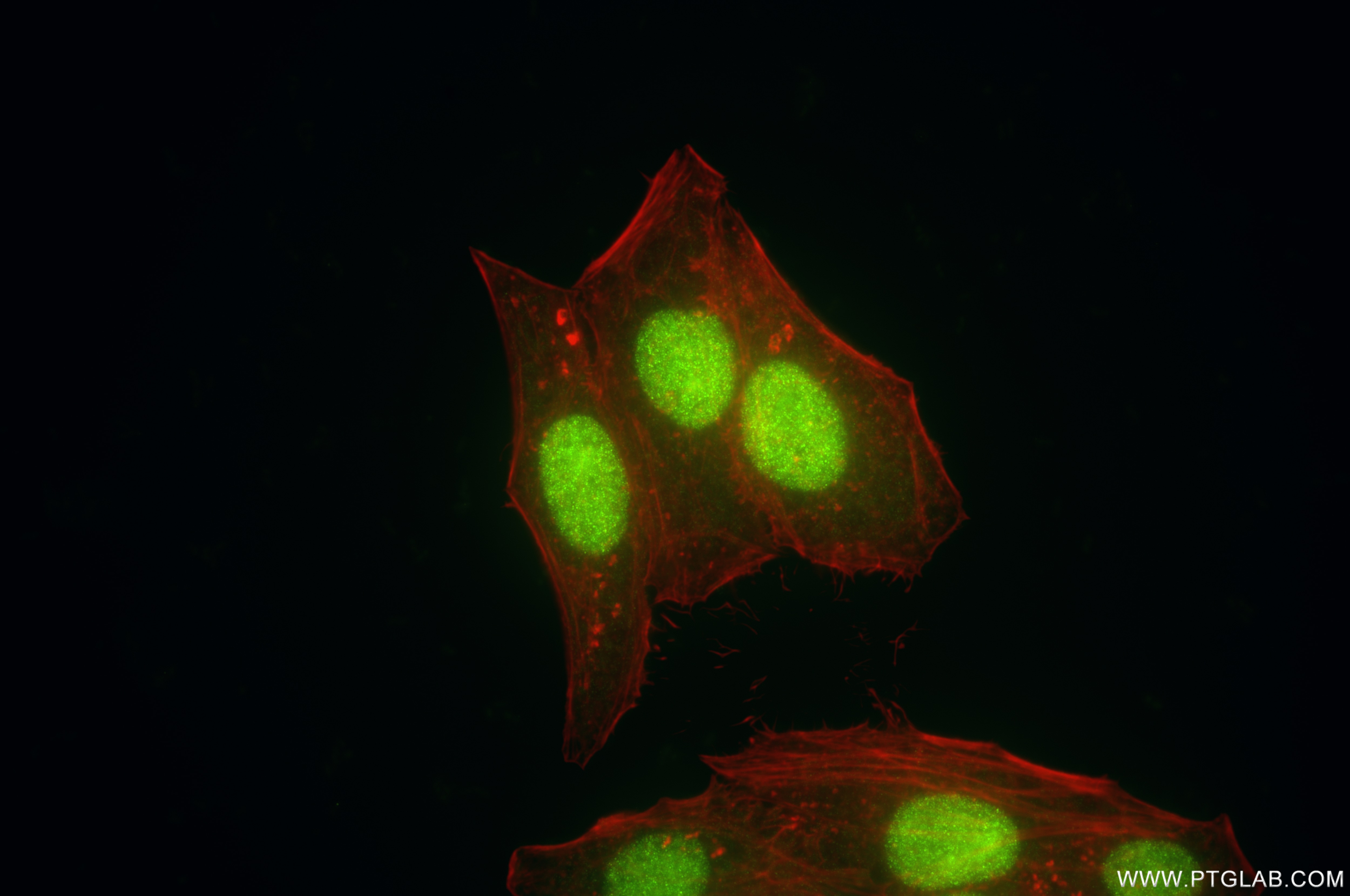 Immunofluorescence (IF) / fluorescent staining of HepG2 cells using GRWD1 Recombinant antibody (86451-3-RR)